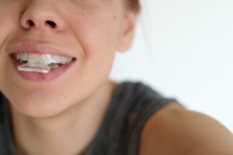 Valkoisemmat hampaat helposti